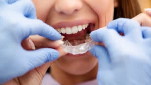 Monashee Dental Centre - Dr Paula Winsor-Lee - Lumby BC - Page Hero - Invisalign